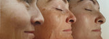 Lily Rose Beauty Schoonheidssalon Apocalypsis huidverjonging Gent